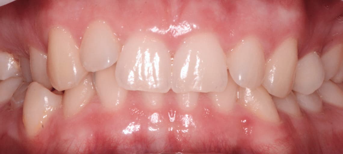 Case 4 before