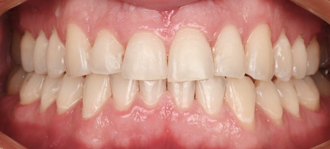 Case 5 after