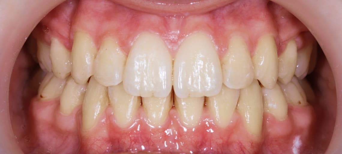 Case 6 after