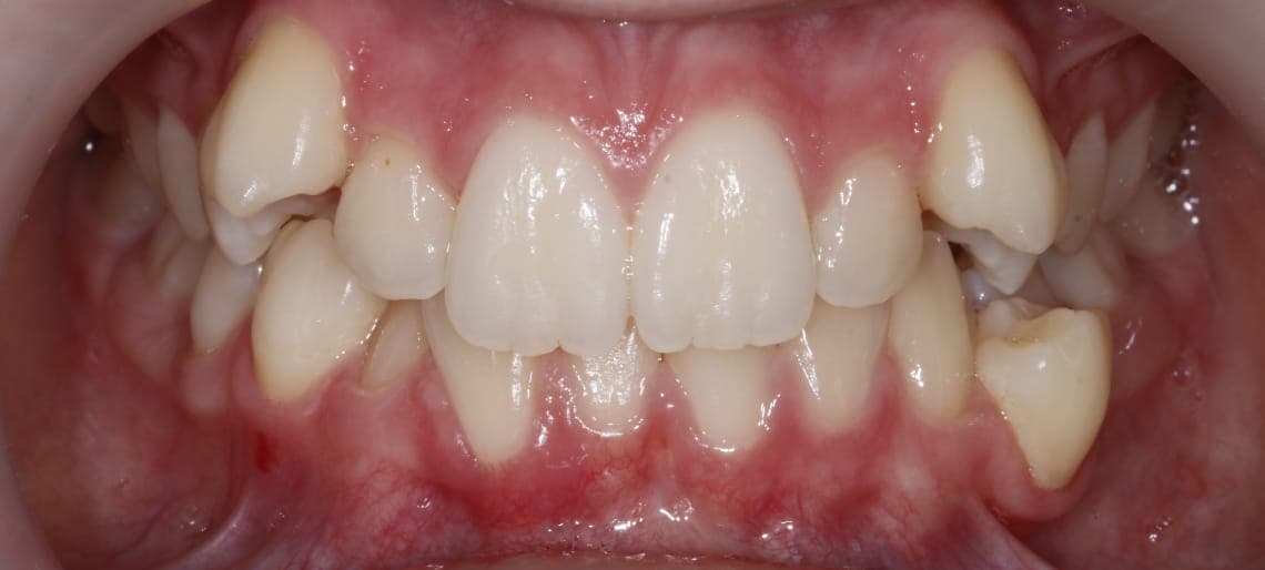 Case 6 before