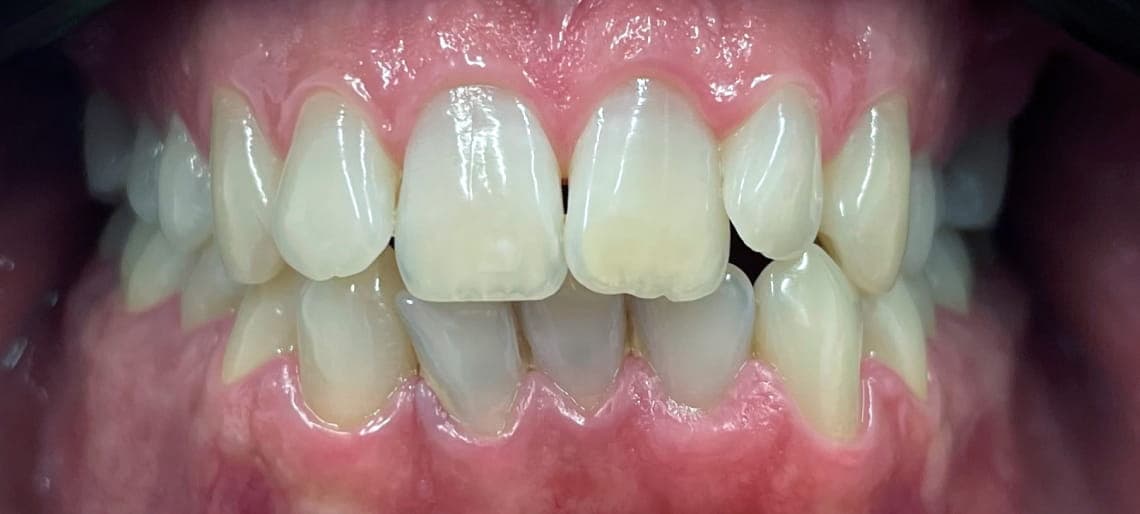 Case 7 before