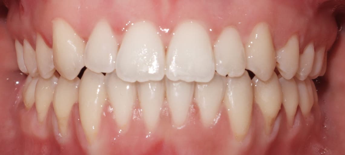 Case 9 after